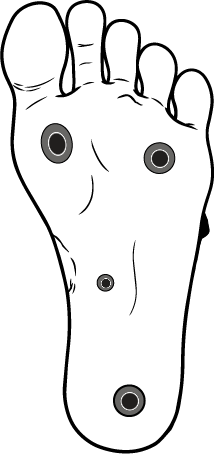 Бородавки